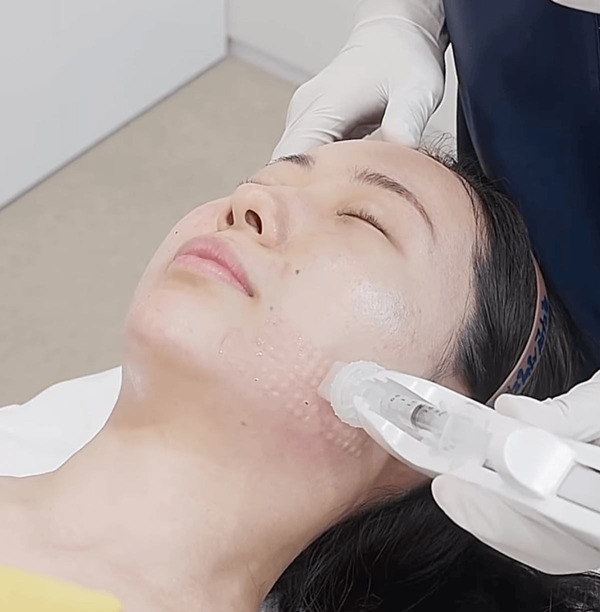 Dr. Seok-yoon performing a precise non-surgical injection at Pladen Clinic Seoul